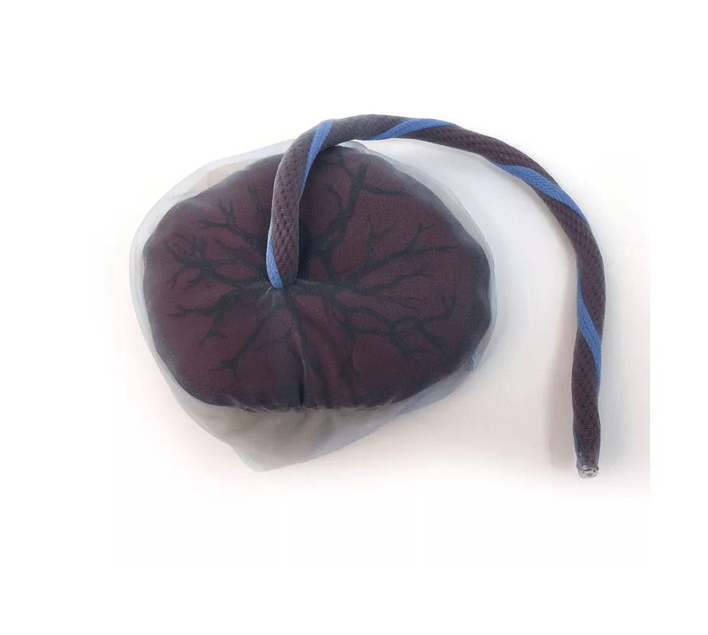 Plazenta und Nabelschnur - Erler - Zimmer